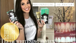 How To Get A Pearly White Smile INSTANTLY : At Home Teeth Whitening | Billion Dollar Smile Review |