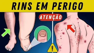 PRINCIPAIS SINTOMAS DE DOENÇA RENAL e SINAIS DE PEDRA NOS RINS CAUSAS E TRATAMENTO