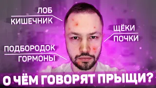 Карта прыщей. Что означает расположение прыщей на лице?