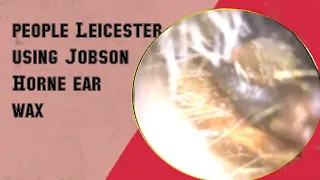 39 people Leicester using Jobson Horne ear wax