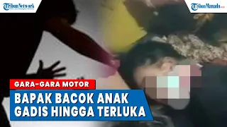 Motor Kesayangan Dibawa tanpa Izin, Bapak Bacok Anak Gadis, Korban Terluka di Pinggang dan Leher