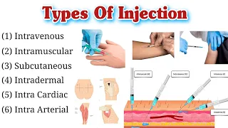 Types Of Injection and Their Site | Route of Injection | Injection Types