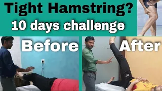 Hamstring Stiffness | How to Make Hamstring Flexible | Best Hamstring Stretches In Hindi