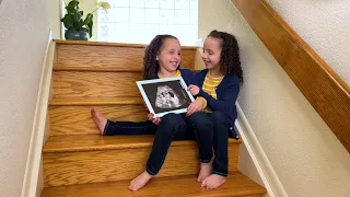 Mila and Ciela’s Twin-to-Twin-Transfusion (TTTS) Success Story