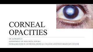 CORNEAL OPACITY