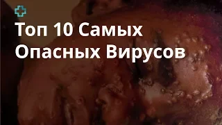 Топ 10 Самых Опасных Вирусов