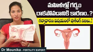 సంతాన లేమికి కారణాలు || Basic Causes Of Infertility || Best Fertility Center || Dr Mounika Ferty9