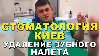 Стоматология Киев: Удаление Зубного Налета 🦷  #Shorts