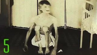 5 Nightmare Fuel Photos from Insane Asylums