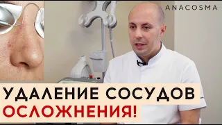 🆘 УДАЛЕНИЕ СОСУДОВ ЛАЗЕРОМ ❗❗❗ ОСЛОЖНЕНИЯ