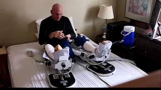 Simultaneous Bilateral Knee Replacement Recovery nonsense video