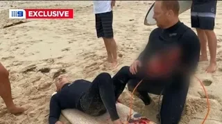 Surfer's leg 'bitten to the bone' in horror shark attack on crowded beach - Today News