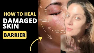 How To Heal Damaged Skin Barrier | How to treat broken skin barrier | Nipun Kapur