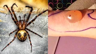 Die 10 Giftigsten Spinnen der Welt!