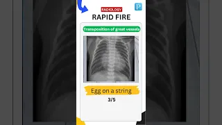 Can you answer a Quick Radiology Rapid fire?