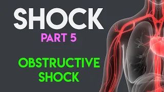 Obstructive Shock | Shock (Part 5)