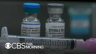 Measles outbreak hits 25-year high with 704 cases reported so far