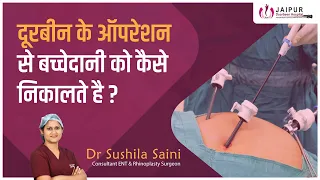 जाने कैसे होता है दूरबीन से बच्चेदानी निकालने का ऑपरेशन?  #uterus Removal Surgery with Hysteroscopy