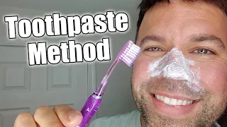 How To Remove Blackheads Fast and Easy