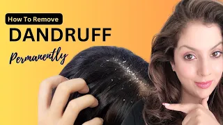 How to Remove Dandruff From Scalp at Home I How to Remove Dandruff Permanently in One Wash