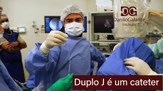 O que é o Cateter duplo J?