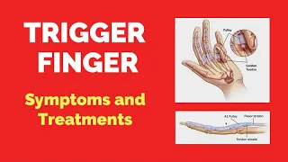 Trigger Finger: SYMPTOMS AND TREATMENTS