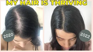 Minoxidil 2 Year Update | Does Minoxidil Work? | Female Hair Loss