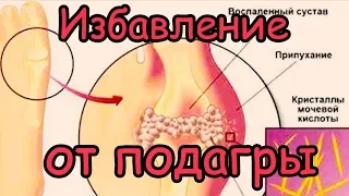 Как Избавиться от Подагры [10 продуктов растворят кристаллы мочевой кислоты и избавят от подагры]