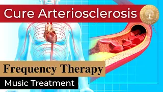 Arteriosclerosis Bioresonance Music Therapy ๏ Rife Frequency Treatment ๏ Healing Nature Frequencies