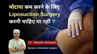 Liposuction For Weight Loss, Cost, Procedure & Side Effects - Dr. Manish Motwani