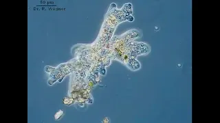 Рух амеби протей (звичайної) Amoeba proteus під мікроскопом