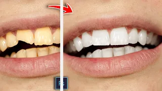 How To Fix & Whiten Teeth In Photoshop (2 Min) | Fix Yellow Teeth