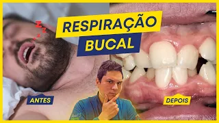 O que acontece com quem respira pela boca?