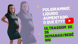 Polidramnio/Líquido aumentado/Ultrassom 35 semanas!!!#maternidade #gravidez