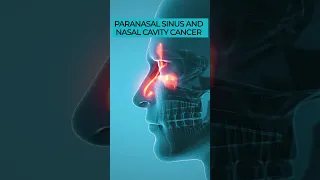 Paranasal Sinus & Nasal Cavity Cancer: Head and Neck Cancer Explained 🎗️🩺