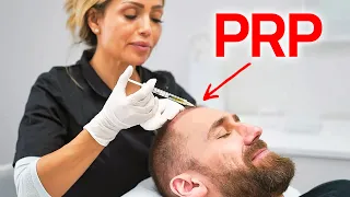 PRP treatment after hair transplant - FAST HAIR REGROWTH