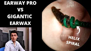 EarWay Pro VS Gigantic Ear Wax Plug (2nd Review)