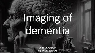 When is it dementia? Imaging in dementia from A(lzheimer) to (Creut)Z(feldt-Jakob).