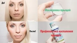 Маскировка и профилактика воспаления прыщей!