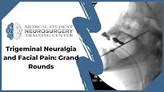 Trigeminal Neuralgia and Facial Pain: Grand Rounds