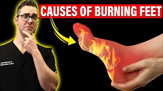 Top 11 Causes of Burning Feet & Peripheral Neuropathy [Instant FIX?]