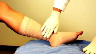 Multi-Layer Compression Wraps for Venous Ulcers- Understand Wound Care