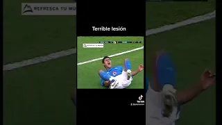 La peor lesión en el fútbol mexicano 😨#lesion #cruzazul #futbol