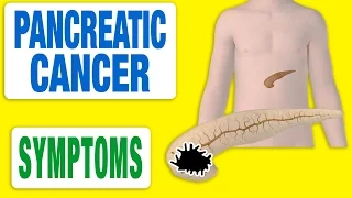 Pancreatic Cancer - All Symptoms