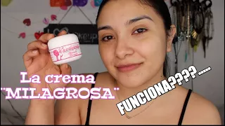 La crema MILAGROSA, funciona? | Mi experiencia