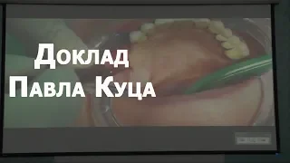 Доклад Павла Куца