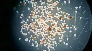 Juvenile Freshwater Pearl Mussels Under a Microscope