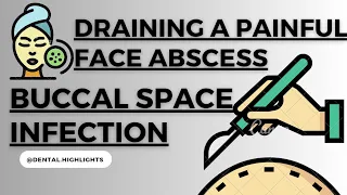 Incision Drainage Procedure Of Buccal Space Infection