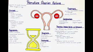 Premature Ovarian Failure (Early Menopause) - Causes, Symptoms, Diagnosis, Treatment, Complications