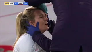 Lauren Hemp gushing head injury with the Lionesses.